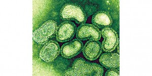 H1N1-virus