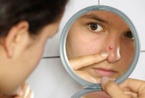 photolibrary_rf_photo_of_girl_looking_at_pimple