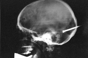 head amazing-x-rays