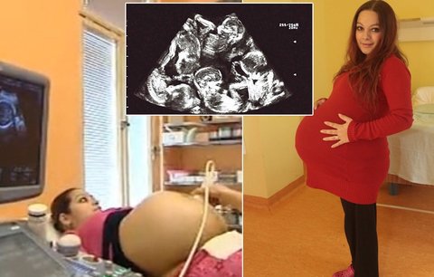 Александра Кинова од Чешка е бремена со петорка - 23 годишната жена која жи...