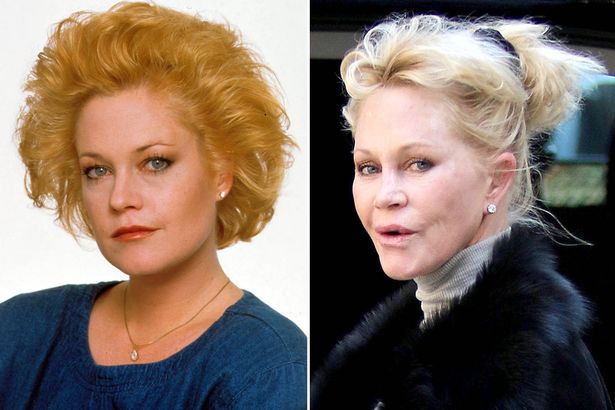 melanie-griffith-before-and-after